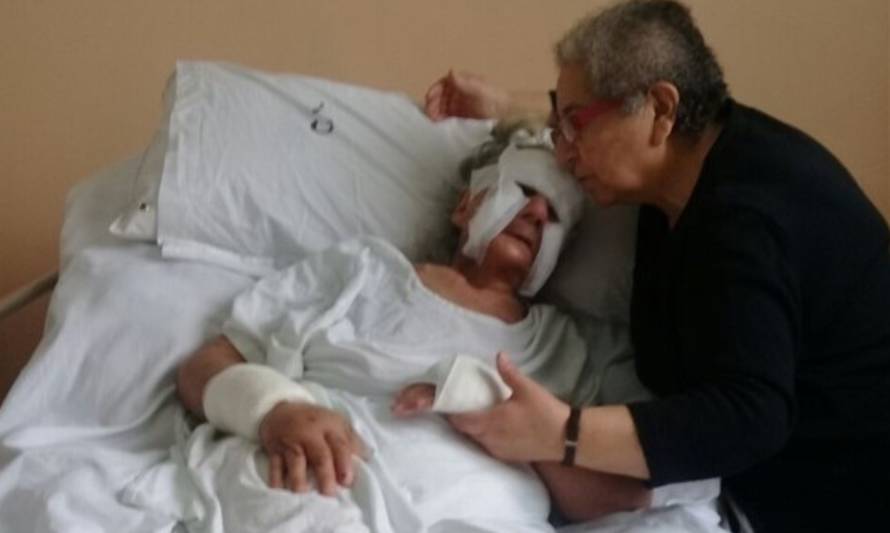 Mujer de 104 años sufrió graves lesiones tras ataque con agua caliente en La Unión