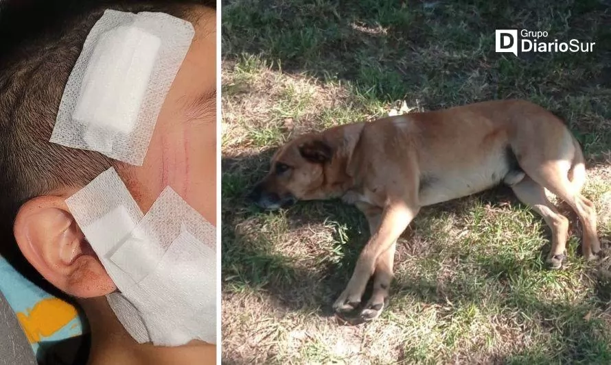 Al menos dos niños han sido atacados por “perro comunitario”en camping laguino 